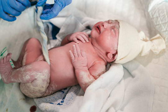 Anonymous doctor touching umbilical cord of newborn