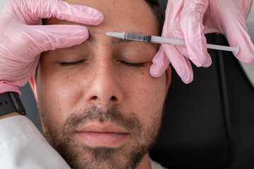 Close Up: Doctor Administering Botox, Applying Wrinkle Treatment for Frown Lines on Male Patient's...