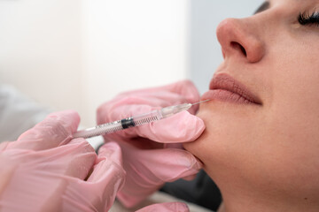 Beautiful woman's mouth and lips in close up: Female doctor cosmetologist injecting Botox for lip rejuvenation skincare
