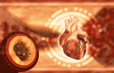 Cholesterol in human heart, Clogged blood vessels. 3d illustration