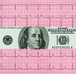 One hundred dollar bill between two pieces of cardiogram results