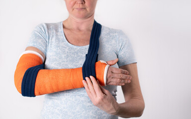 middle aged woman with broken arm in cast hangs her arm in a sling, modern treatment methods, on a...