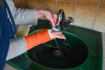 woman with a broken right arm in a cast washes her fingers free of a bandage under running water in...