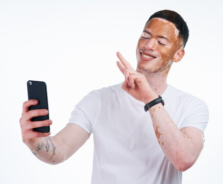 Happy man, vitiligo and selfie with peace sign for memory, picture or photography on a white studio background. Young or handsome male person with smile or emoji for capture, moment or social media