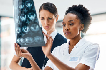 Hospital, team and women doctors with MRI scan for review, diagnosis or X-ray consultation....