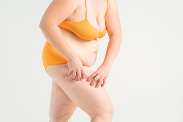 Overweight woman, fat legs with varicose veins and stretch marks, obesity female body with cellulite on gray background