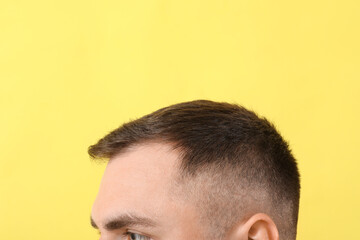 Young man with hair loss problem on yellow background, closeup