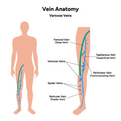 Vein anatomy, varicose veins