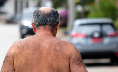 A naked hairy man walks down the street. Back view
