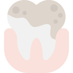 Dental Plaque Illustration