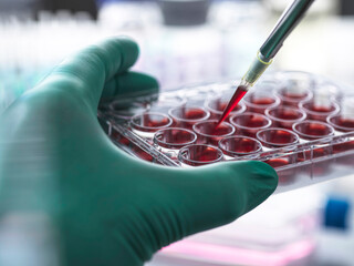 Scientist putting blood in multi well dish at laboratory