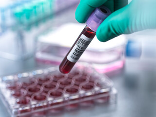Scientist holding blood collection tube at laboratory
