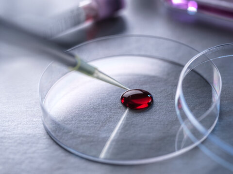 Scientist examining human blood sample for DNA test