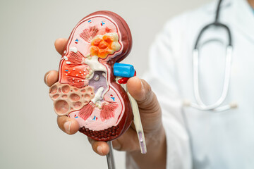 Kidney disease, Chronic kidney disease ckd, Doctor with human model to study and treat in hospital.