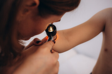 Close-up Of Doctor Examining Skin Of Child Patient With Dermatoscope