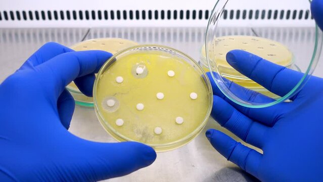 Scientist opens a petri dish with white disks inside, test for the effect of antibiotics on bacterial growth in the laboratory, close-up.