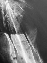 Black and white rays of light