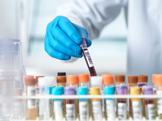 Scientist handling a blood sample in a laboratory