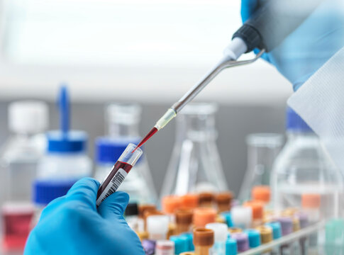 Lab technician pipetting a blood sample