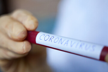 Hand holding blood test result for Coronavirus