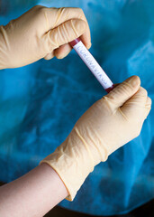Hands holding blood test result for Coronavirus
