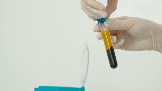 The doctor takes out tubes from the centrifuge with plasma. She does this very slowly and carefully so that it does not mix again. High quality 4k footage