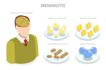 3D Isometric Flat  Illustration of Meningitis, Meningococcal Disease, Dangerous Meninges Inflammation