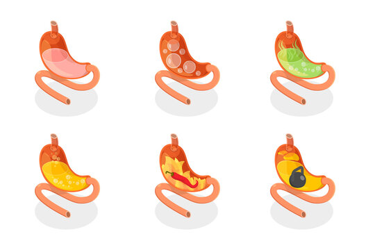 3D Isometric Flat  Set of Stomach Problems, Digestive System Issues