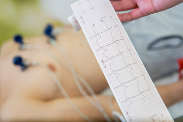 Clinical analysis in progress, precision cardiac monitoring at a modern healthcare facility