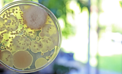 Mould test petri dish culture medium with spore colonies for measuring mold contamination in the air indoors (focus on center of dish)