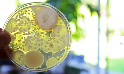 Mould test agar petri dish culture medium with spore colonies for measuring mold contamination in...