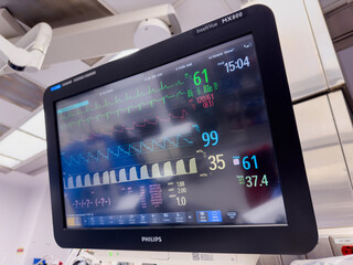 Hospital monitor displays vital signs in ICU, reflecting science and healthcare urgency