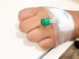 Intravenous cannula on hand. Venous access device is placed inside a vein to provide saline or medication administration.