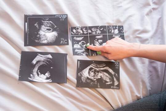 Expectant Mother Reviewing Ultrasound Images