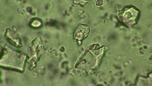 Microscopic examination of a probiotic at 1000x zoom, revealing dynamic crystals and bacteria aiding digestion.
