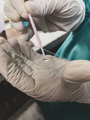Surgeons hand holding a test tube with blood sample in a hospital. Closeup heath study - obrazy, fototapety, plakaty