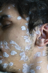 a chickenpox rash on the face of a young man. chickenpox. traces of the disease. skin disease