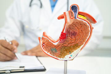 Stomach disease, doctor with human anatomy model for study diagnosis and treatment in hospital.