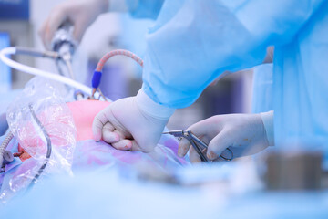 Closeup surgeon hold surgical equipment in minimal invasive endoscopic surgery, blue light. Team...