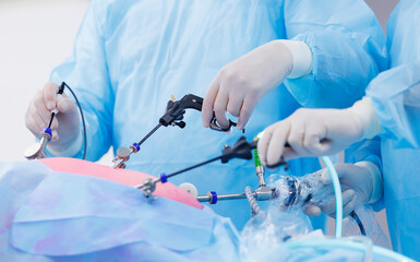 Team doctors use medical instrument for laparoscopic cholecystectomy stomach, operating room...