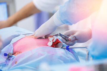 Modern laparoscopic equipment, doctor surgery working, sunlight. Operation process on abdominal,...