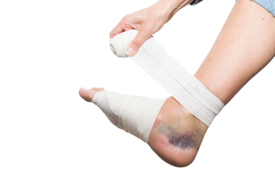 person bandaging foot, sprain, strain, inflammation, medicine