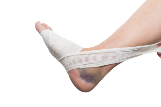 close up of bandaged foot, sprain, strain, inflammation, rehabilitation