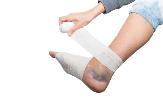 hand bandaging foot, sprain, strain, inflammation, fracture, medicine, close up