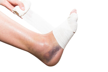 close up of hand bandaging foot, sprain, strain, inflammation, rehabilitation