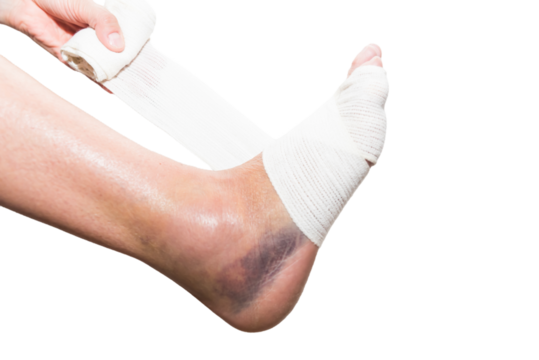 close up of hand bandaging foot, sprain, strain, inflammation, rehabilitation