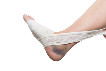 close up of bandaged foot, sprain, strain, inflammation, rehabilitation