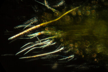 Hairy bract of a rhododendron flower bud at 100x.