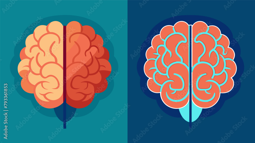 Poster a side by side comparison of brain scans one before and one after deep brain stimulation treatment s
