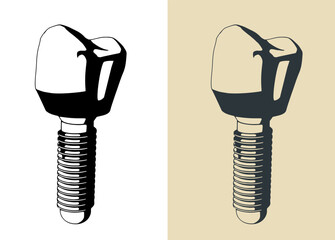 Dental prosthesis illustrations - 793369016